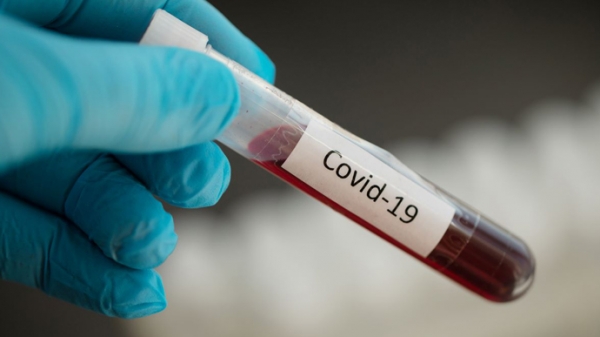 Кіровоградщина: на COVID-19 захворіли 674 особи