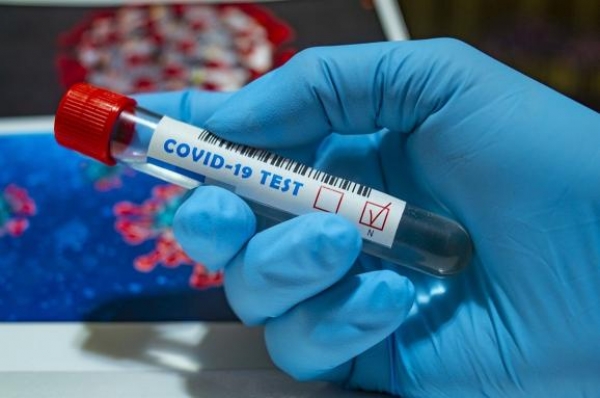 На Кіровоградщині виявили 5 нових інфікованих коронавірусом