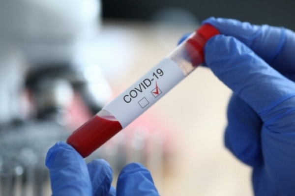 Епідемія поширюється: на Кіровоградщині виявили одразу 20 інфікованих коронавірусом
